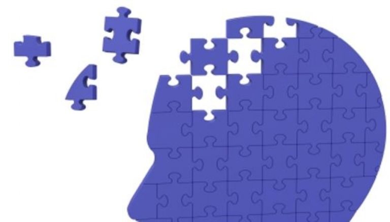 alzheimer