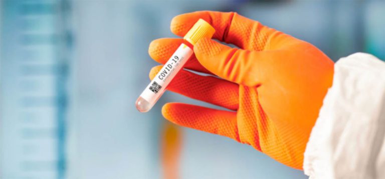 acli coronavirus