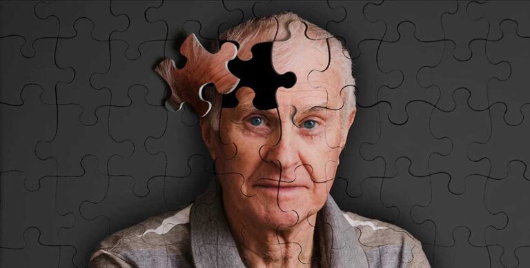 acli Alzheimer