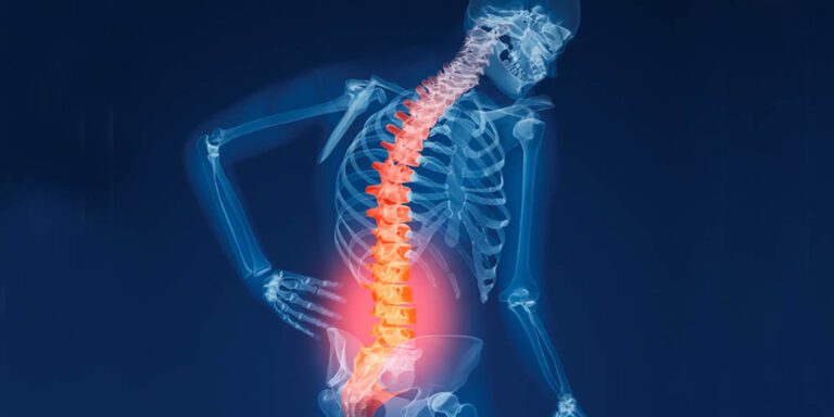 acli fap osteoporosi