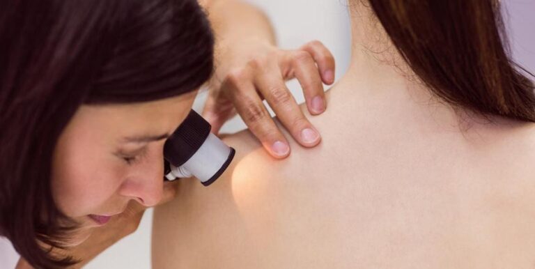 acli dermatoscopio prevenzione
